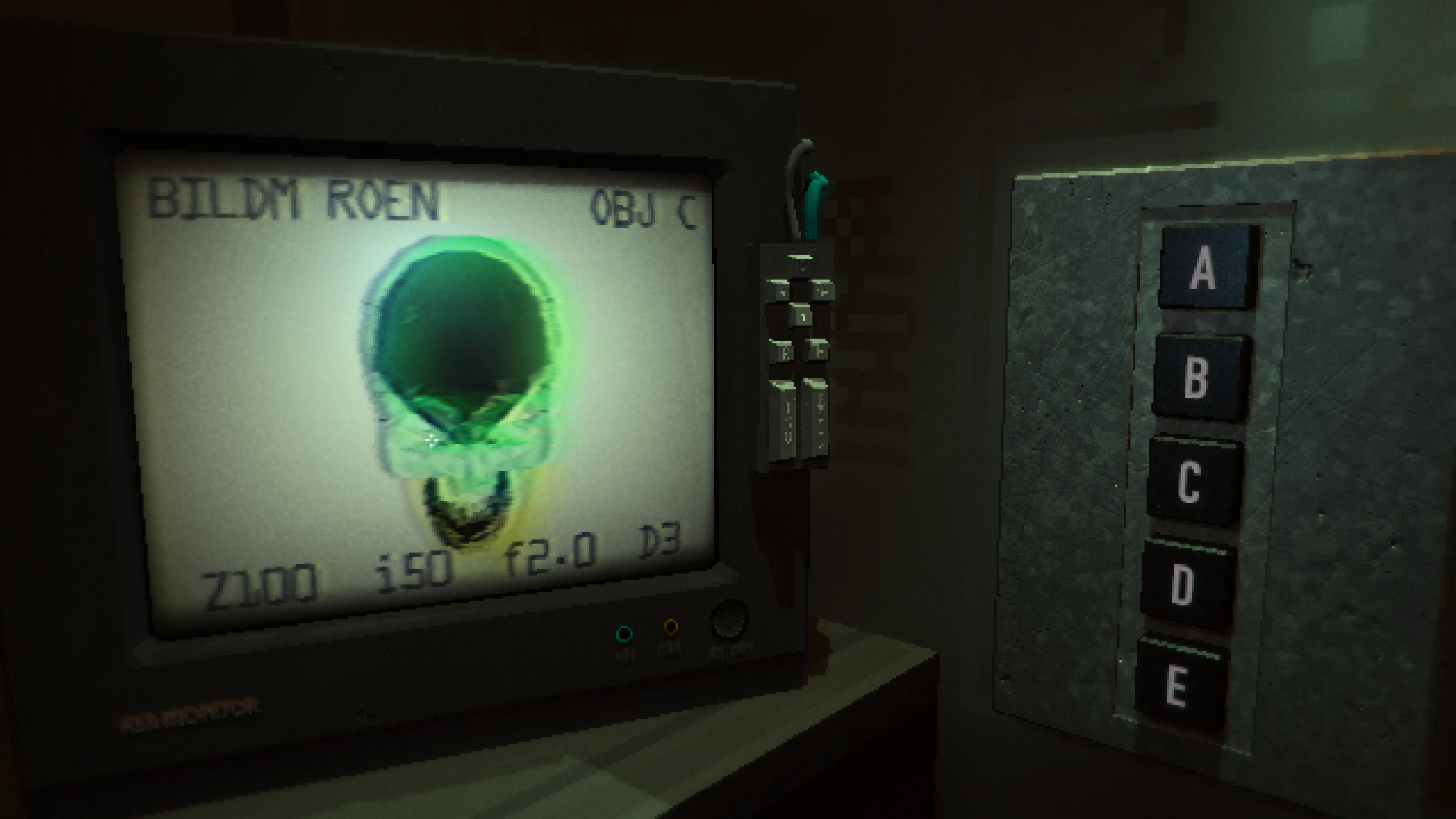 Projectworlds Pneumonia Prediction Using Chest X Ray vrogue.co