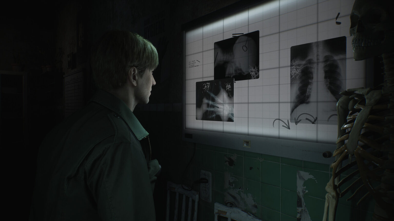 Silent Hill 2 Remake Leaked Image Sparks Debate With Fans - Gameranx