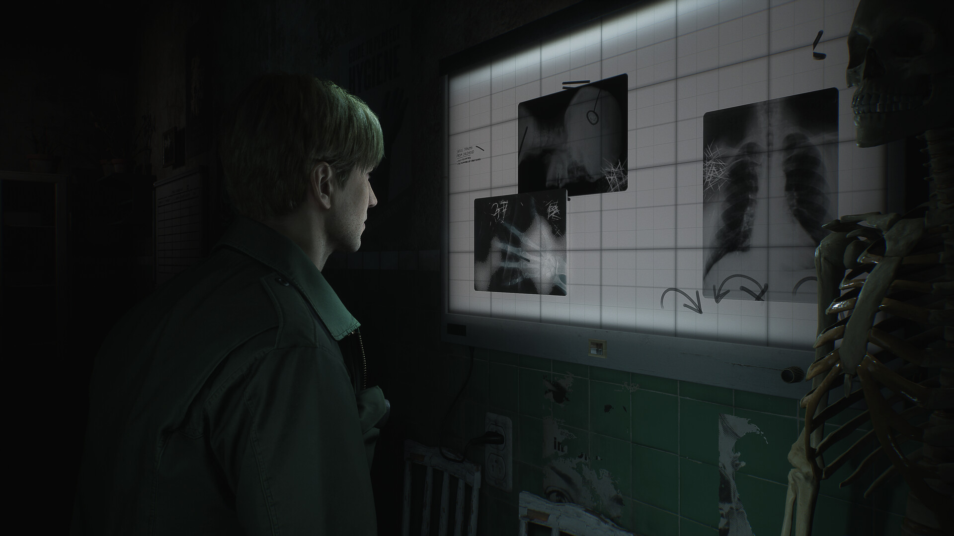 Rebs Gaming on X: The Silent Hill 2 leaks seem to be true. Here are clear  versions of the blurry leaked images I shared. Another Silent Hill leak  incoming shortly  /